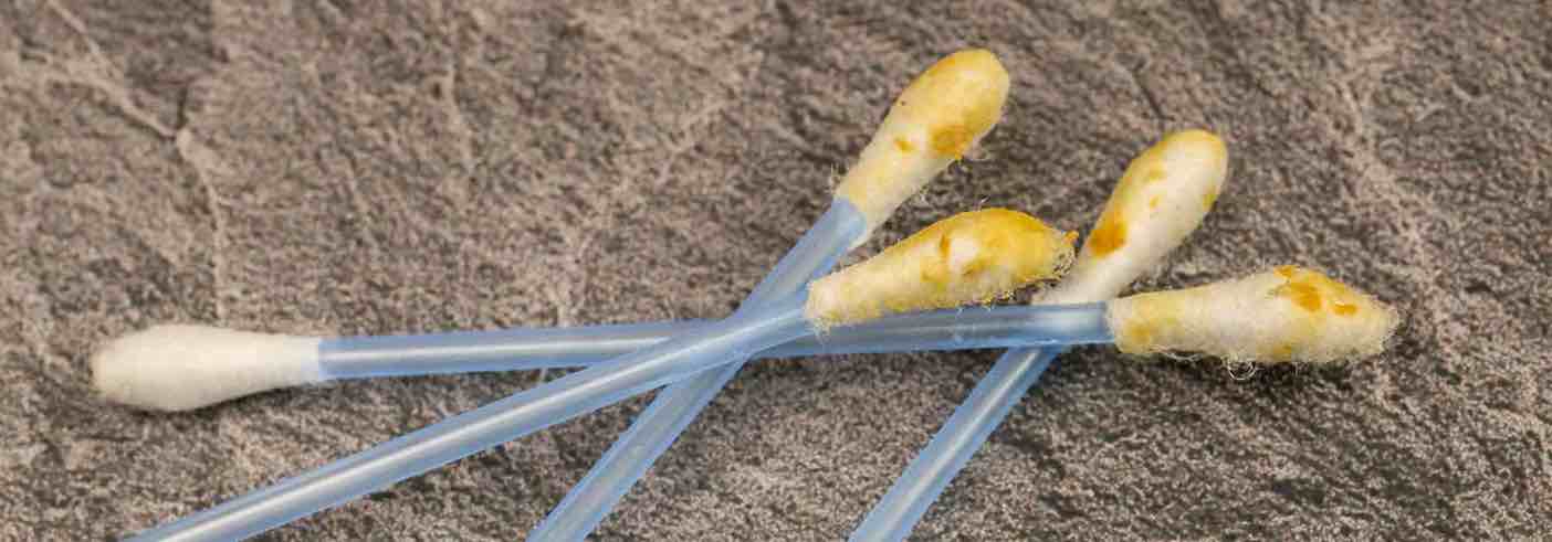 How to dislodge earwax safely