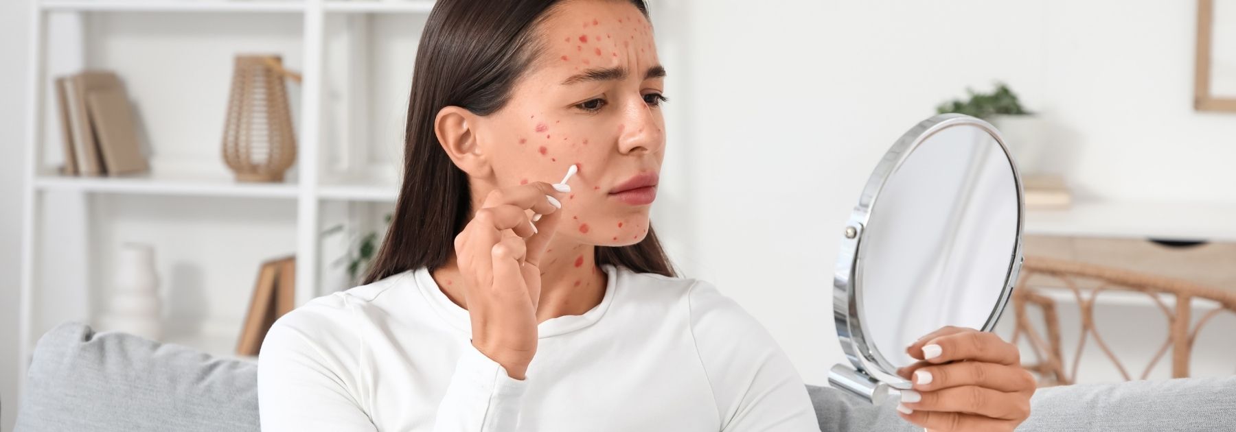 Can You Get Chickenpox Twice